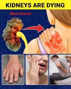 9 Warning Signs Your Kidneys Are Failing in Children