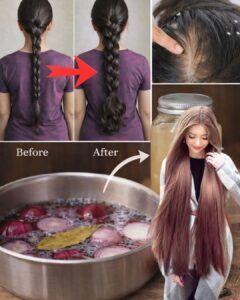 How to Grow Long, Thick Hair with Onion | After Doing This, Your Hair Will Never Stop Growing