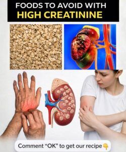 High Creatinine: Smart Changes That Protect Your Kidneys