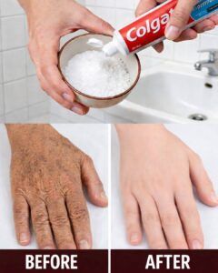 Natural Anti-Aging Remedy for Hands & Arms: Smooth Wrinkles and Fade Spots Naturally