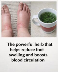 Top 8 Diuretic Teas to Reduce Swelling & Water Retention Naturally