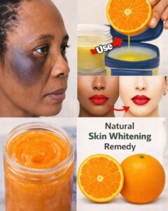 The Best Way To Use Vaseline and Lemon on Skin for Dark Spots, Wrinkles & Glowing Skin