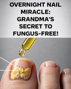 Simple “Nail Spice” Ritual That Helps Clear Toenail Fungus Naturally
