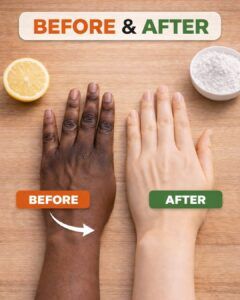 Hand and Body Tan Removing Easy Home Remedy – 100% Effective Natural Method