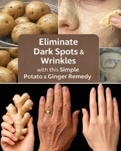 Eliminate Dark Spots and Wrinkles Naturally: A Simple Homemade Remedy for Younger-Looking Skin