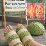 7 Natural Ways to Ease Arthritic Bone-on-Bone Pain and Regain Comfort