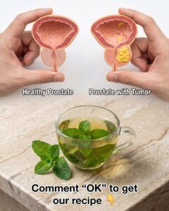 The Herbal Drink That Supports Prostate Health and Helps Reduce Cancer Risk