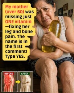Just One Missing Vitamin Triggers Aching Legs and Bones After 65