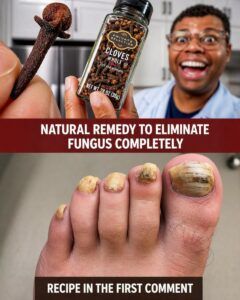 🌿 Clove for Nail Fungus: A Gentle Natural Care Option