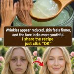 Natural Home Remedies for Wrinkles Around the Mouth: Simple Ways to Help Smooth Fine Lines Around the Lips