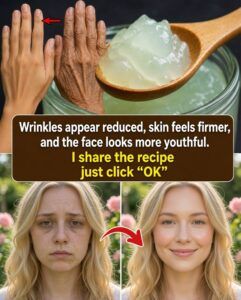 Natural Home Remedies for Wrinkles Around the Mouth: Simple Ways to Help Smooth Fine Lines Around the Lips