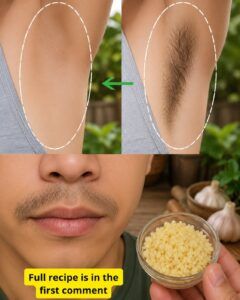 How Garlic May Support a Smoother-Looking Appearance: A Gentle Natural Care Guide