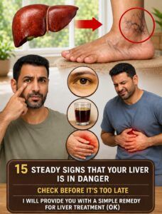 Fatty Liver: Warning Signs and Natural Ways to Support Liver Health