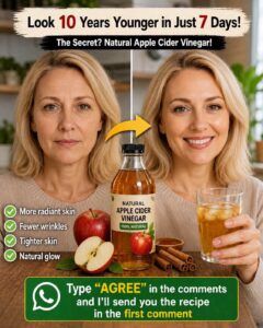 Discover How Apple Cider Vinegar May Help Your Skin Look Healthier and More Radiant Naturally 🍎✨