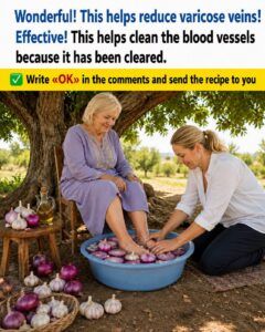 Amazing! This Natural Remedy May Help Reduce the Appearance of Varicose Veins Naturally