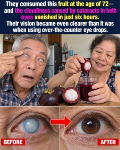 Cloudy Cataracts Steal Night Driving and Faces: What Mangosteen Research Really Shows