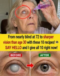 Go From Nearly Blind At 72 To Having Sharper Vision Than A 30-year-old With These 10 Formulas