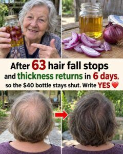 Skip the $40 Hair Bottles — Onion Oil Forces Hair Fall to Slow and Thickness to Return