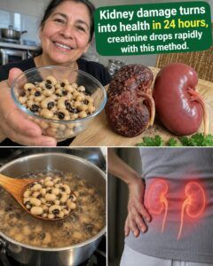 High Creatinine Is Hammering Your Kidneys — These 7 Foods Change the Load
