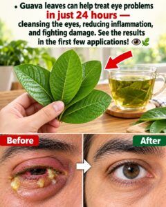 Guava Leaves and Eye Infections: What to Know Before Trying a Home Remedy