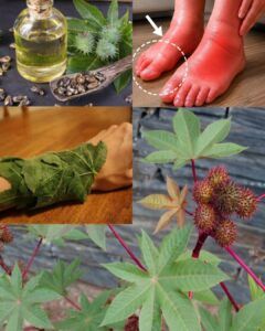 Castor Oil Packs for Swollen Joints: A Gentle Traditional Comfort Routine Worth Knowing