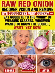 Raw onions and eye health: what they can help with — and what they can’t “reverse”.