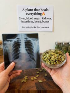 Holding X ray film and seeds 20260916084750 Holding X ray film and seeds 20260916084750