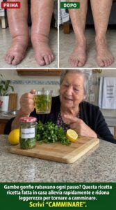 Gambe gonfie, passi pesanti: la ricetta al prezzemolo che ti farà sentire leggero.