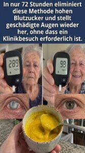 Geschädigte Augen klären sich, wenn der Blutzuckerspiegel nicht mehr so ​​stark ansteigt.