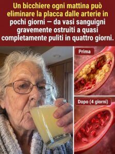 La bevanda gialla allo zenzero innesca un cambiamento nascosto nella circolazione nelle arterie ostruite dalla placca