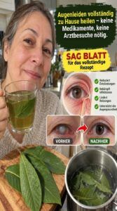 Eyebright sorgt für schnelles Aufhellen roter, verschwommener Augen.