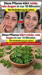 Diese Pflanze lässt geschwollene Augen schnell abklingen.