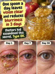 A spoonful of apple a day clears the vision and dispels cloudy eyes.