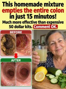 This Homemade Mixture Unblocks the Colon and Soothes a Bloated Abdomen