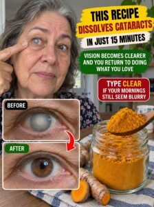 This golden spice brightens the eyes and defies cataracts.