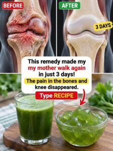 This green juice for bone and knee pain ignites relief.