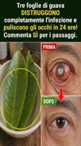 3 foglie di guava innescano un brutale reset negli occhi infiammati e infetti