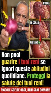 Non puoi guarire i tuoi reni se continui a ripetere questi 10 comportamenti dannosi quotidiani.