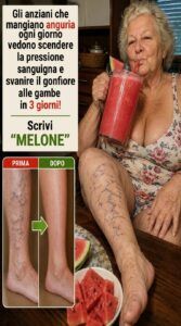 Mangia anguria per favorire una sana circolazione e ridurre il gonfiore alle gambe in modo naturale.