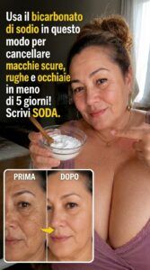 Usa il bicarbonato di sodio in questo modo per combattere melasma, rughe e occhiaie.