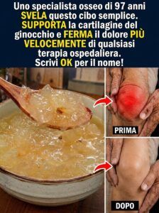 Dopo i 70 anni la cartilagine del ginocchio si assottiglia: ecco un alimento che la sostiene e allevia il dolore.