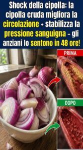 La cipolla cruda fa scorrere un fiume bollente attraverso le arterie ristrette