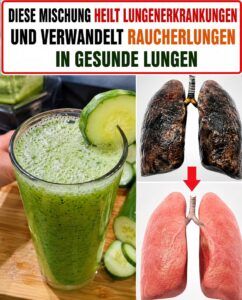 Gurken-, Ingwer-, Minz- und Zitronenwasser: Was es im Körper bewirkt