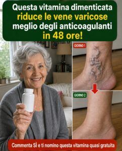 Quelle vene nodose alla caviglia non si appiattiranno in 48 ore: ecco cosa fa davvero la vitamina dimenticata