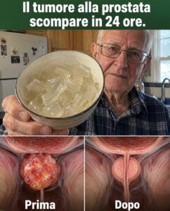 Questa bevanda verde costringe la prostata a smettere di comprimere la vescica