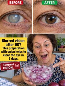 Blurred vision after 60: onions trigger the mechanism that clears the fog.