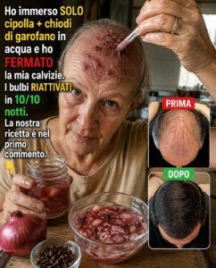 Cosa fanno cipolla e chiodi di garofano a un cuoio capelluto diradato