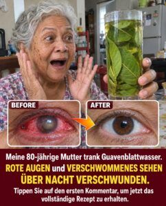 Rote, verschwommene Augen verlieren morgens ihre Kraft, nachdem dieser oft übersehene Küchenaufguss die müden Gefäße erreicht hat.