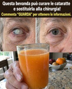 Vista offuscata dopo i 58 anni: cosa stimolano gli spinaci e il tuorlo d’uovo all’interno degli occhi che invecchiano