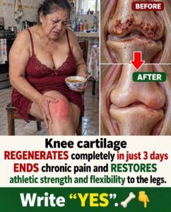 Does knee cartilage regenerate in 3 days? What really helps